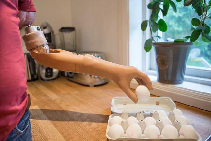 A person with a bionic prosthetic arm retrieves an egg from a carton on a kitchen counter